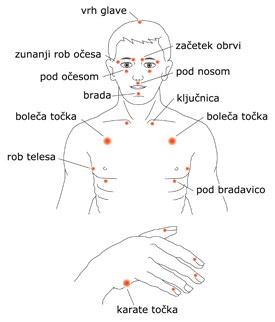 tehnika